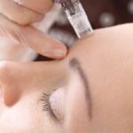 The Aftercare Of Microneedling: How To Take Care Of Your Skin Post-Treatment